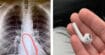 Il s'endort avec ses AirPods sur les oreilles et se réveille avec un écouteur dans le ventre